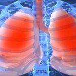 Doktorlar Kadar İyi Teşhis Koyan Röntgen Yapay Zekası